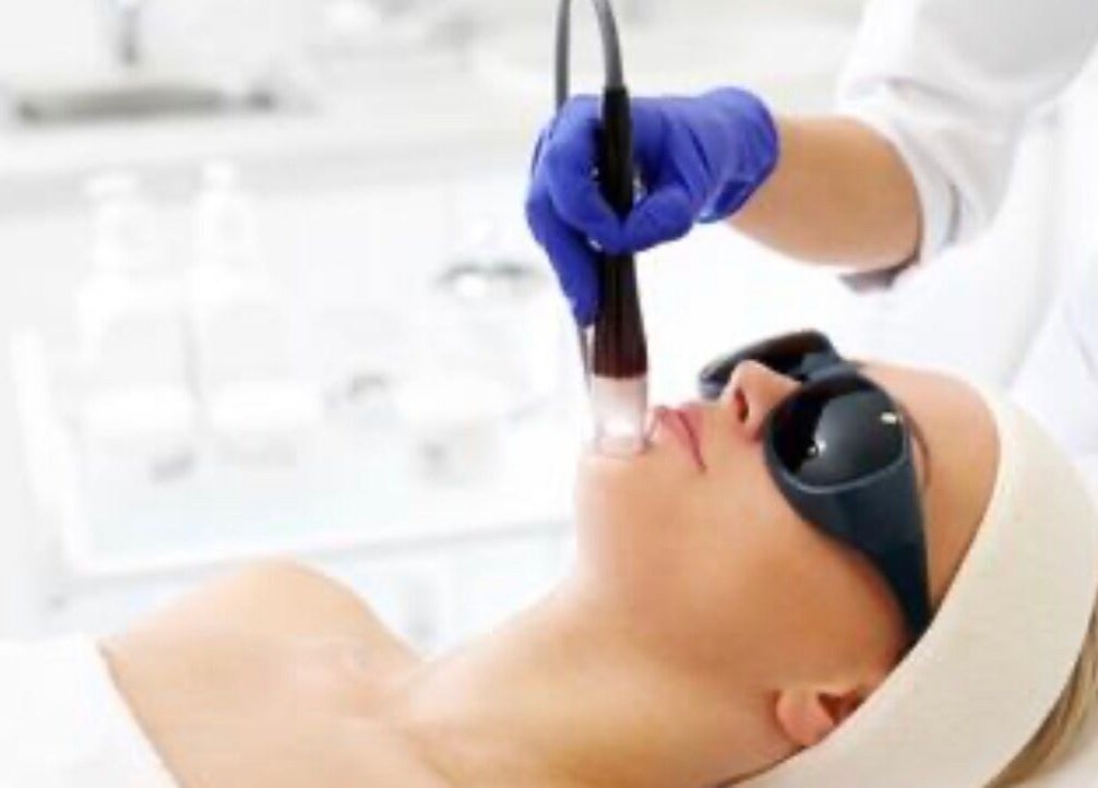 Facial laser treatment at Voko Beauti, Chilliwack, British Columbia, CA for radiant skin.
