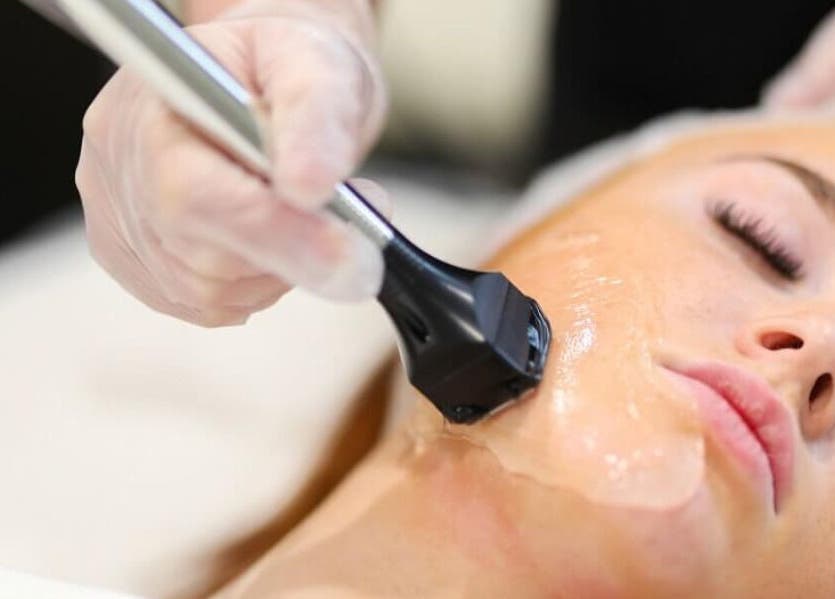 Facial treatment at Evolve Aesthetics and Skin Marmion, enhancing skin health in Marmion, Western Australia, AU.
