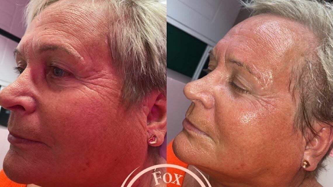 Fox Aesthetics Manor Park Houghton Regis Fresha