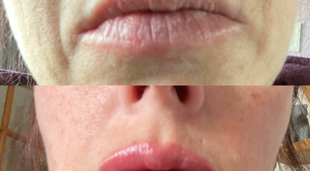 Imagen 3 de SoLuna Micropigmentation 