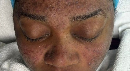 Close-up of facial skin treatment at The Beauty Boss Bureau, Nassau, New Providence, BS.