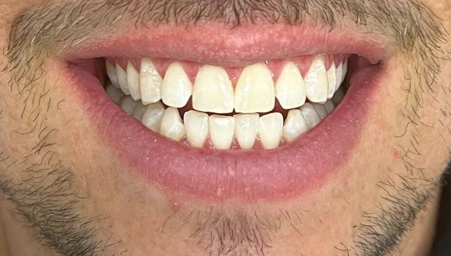 Sydney Teeth Whitening obrázek 1