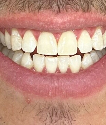 Sydney Teeth Whitening obrázek 2