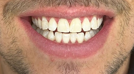 Sydney Teeth Whitening