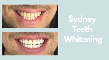 Sydney Teeth Whitening – kuva 2