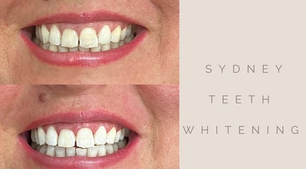 Sydney Teeth Whitening 2paveikslėlis