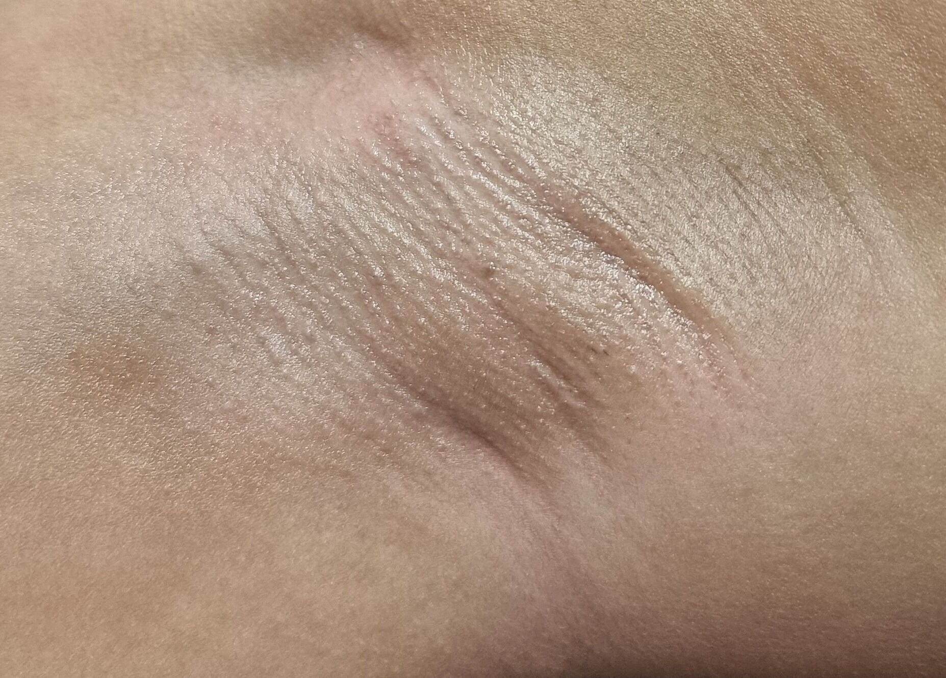 Close-up of smooth skin post-treatment at Giselle Wax Room, Curepe, TT.