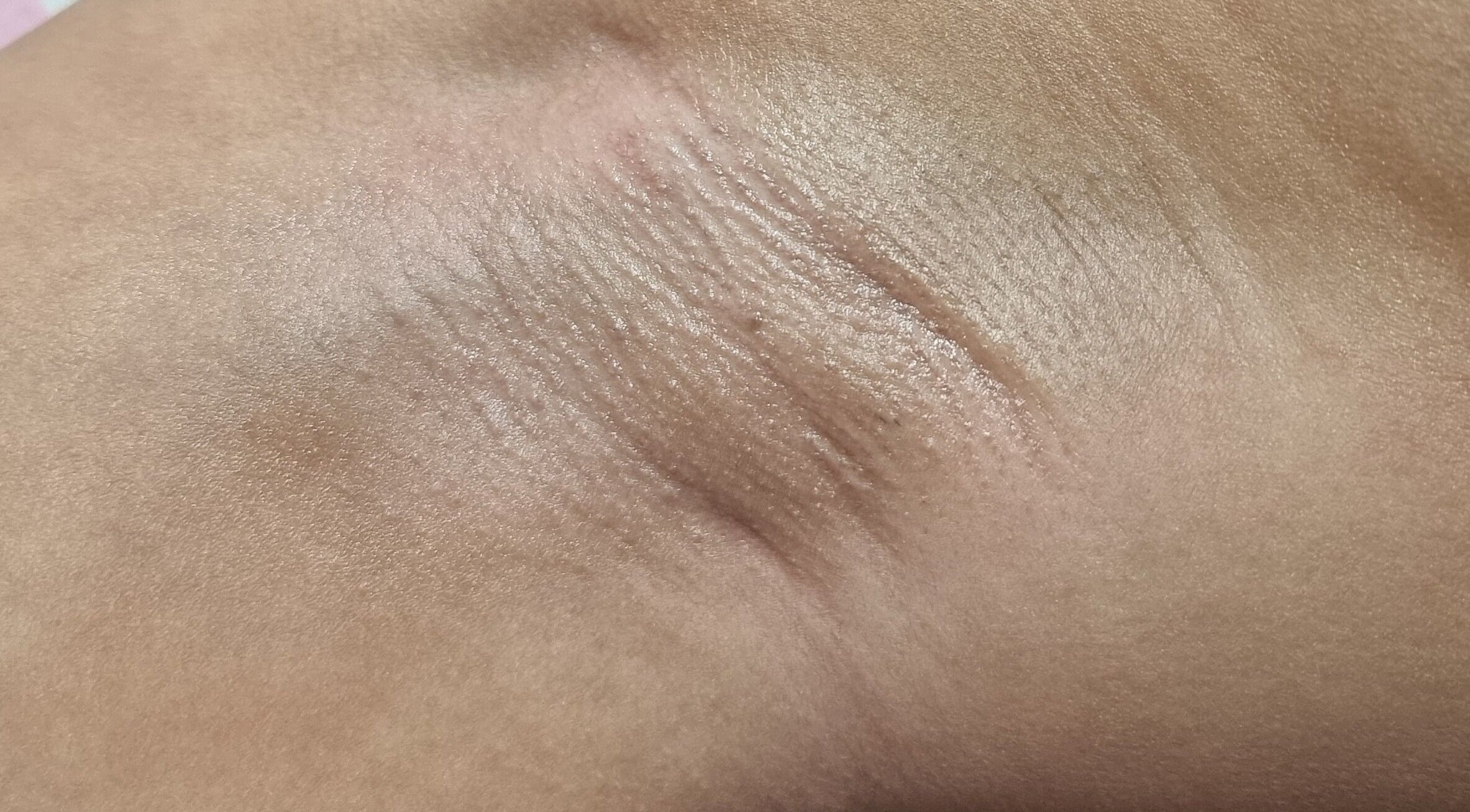 Close-up of smooth skin post-treatment at Giselle Wax Room, Curepe, TT.