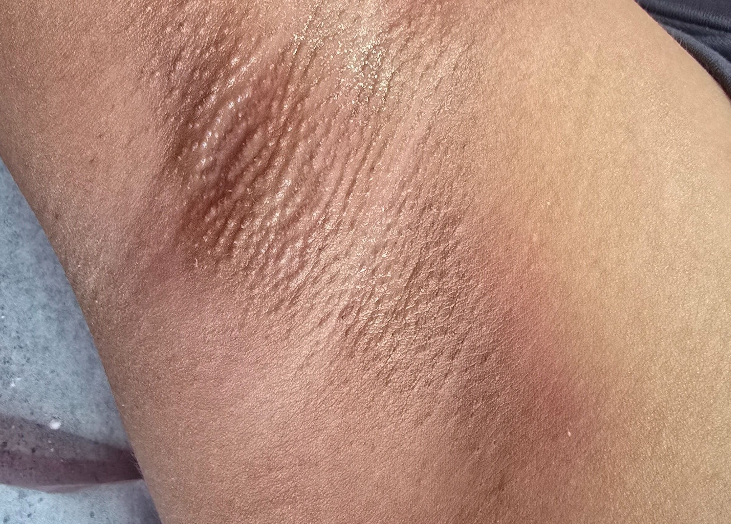 Exquisite smooth skin detail at GISELLE WAX ROOM-(CHAGUANAS), Chaguanas, Chaguanas, TT.