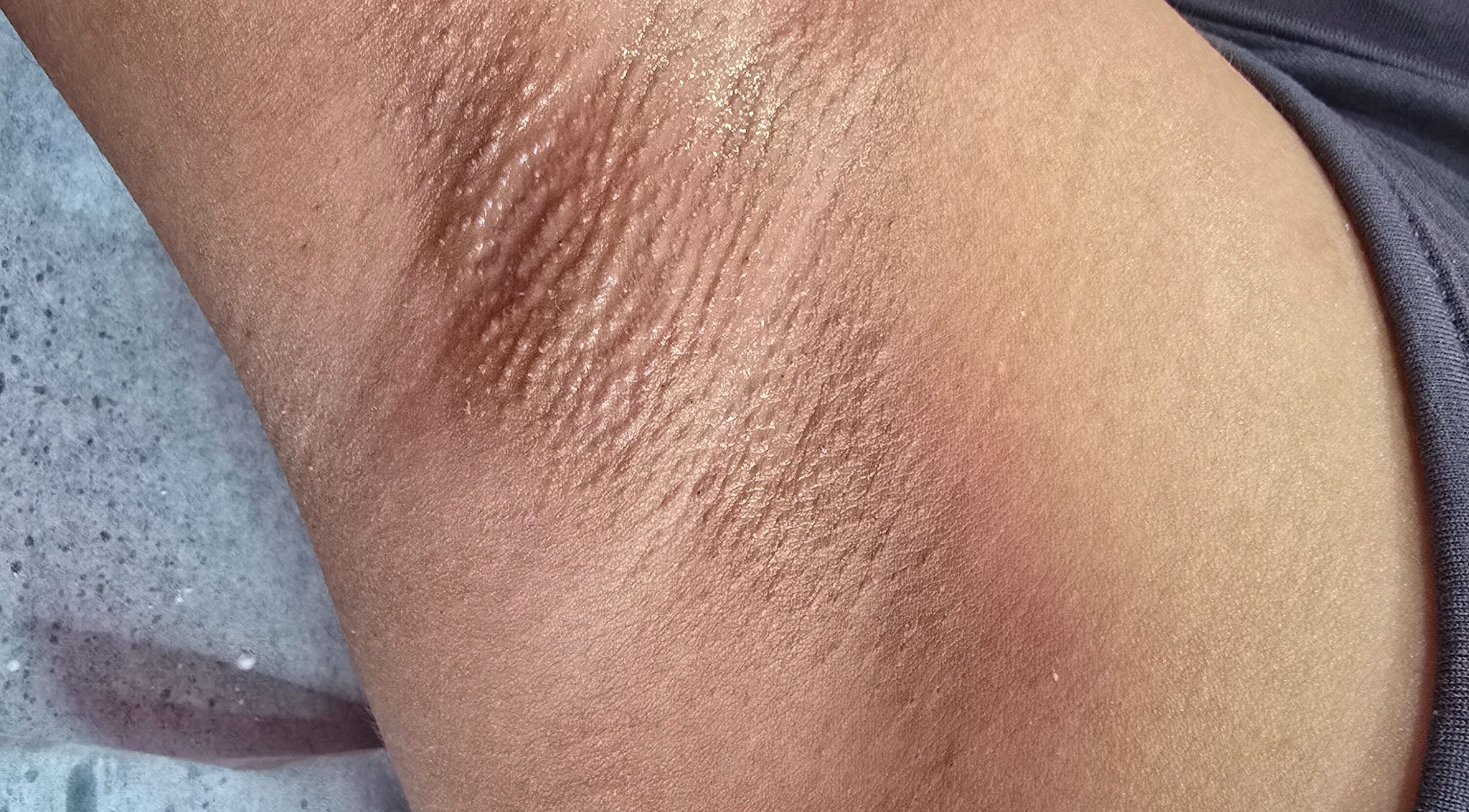 Exquisite smooth skin detail at GISELLE WAX ROOM-(CHAGUANAS), Chaguanas, Chaguanas, TT.