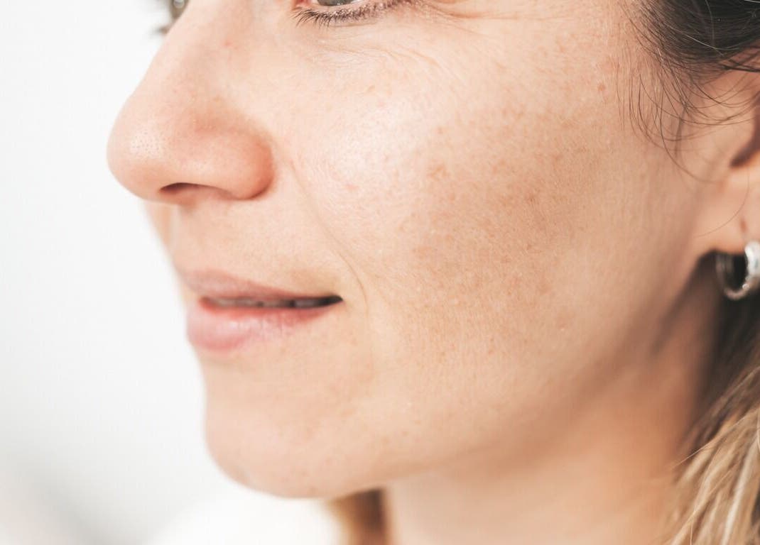 Perfil de mujer disfrutando tratamiento en Espacio malaquita, La Plata, Provincia de Buenos Aires, AR.