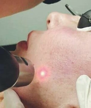 Point Laser image 2