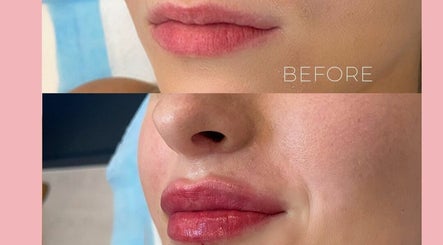 Zion Beauty Clinic - Jindale DFO  image 3