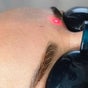 Bonlaser by Essence