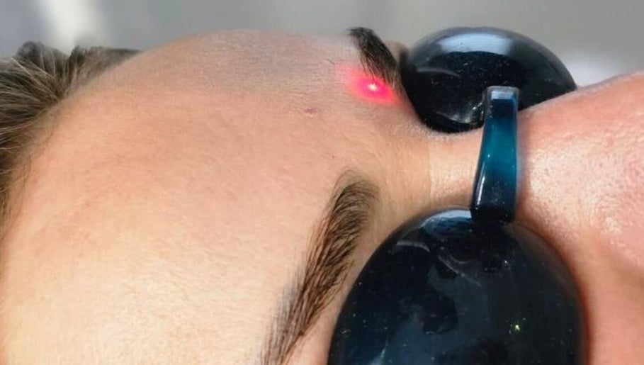 Laser treatment on forehead at Bonlaser by Essence, Kralendijk, Bonaire, BQ. Precision beauty care in action.