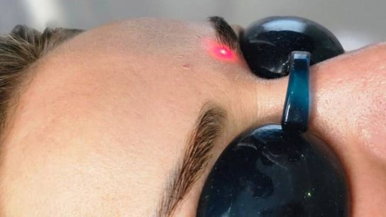Bonlaser by Essence