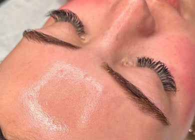 Close-up of a facial treatment enhancing skin glow at LH Skin Clinic, Birmingham, England, GB.
