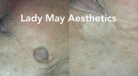 Lady May Aesthetics Skin Clinic image 2