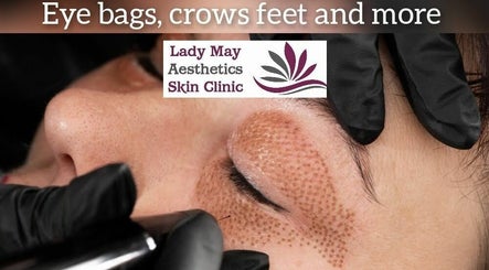 Lady May Aesthetics Skin Clinic image 3