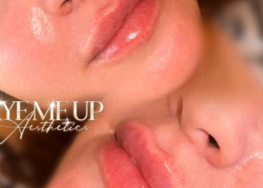 Glowing lips at Eye Me Up Aesthetics, Rainham, England, GB, showcasing exceptional beauty treatments.