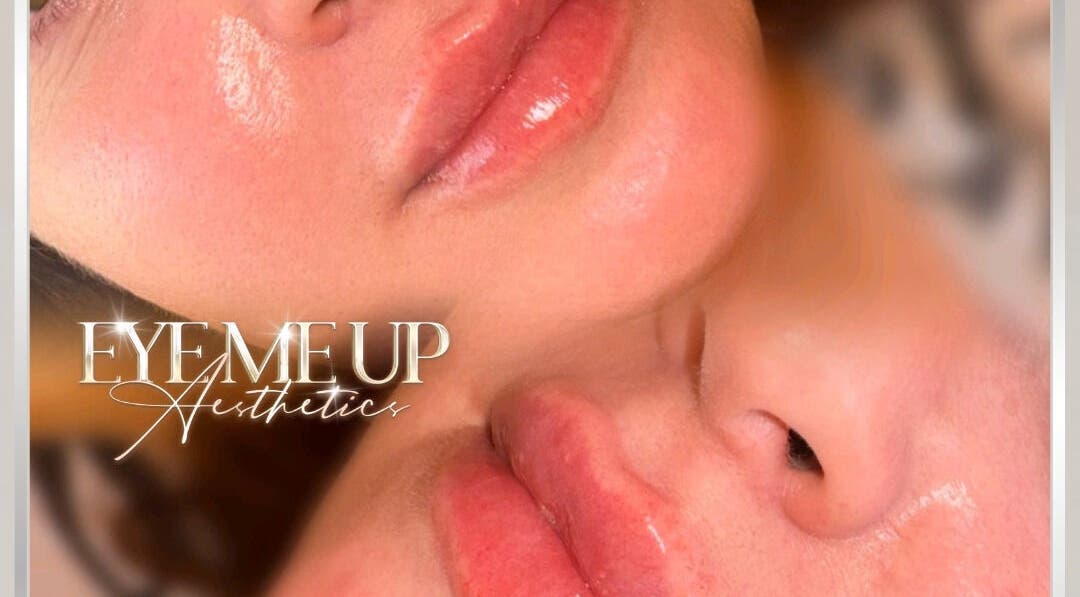 Glowing lips at Eye Me Up Aesthetics, Rainham, England, GB, showcasing exceptional beauty treatments.