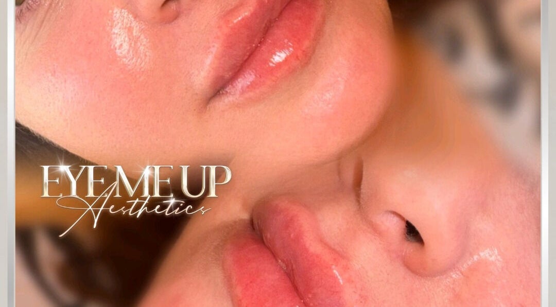 Glowing lips at Eye Me Up Aesthetics, Rainham, England, GB, showcasing exceptional beauty treatments.