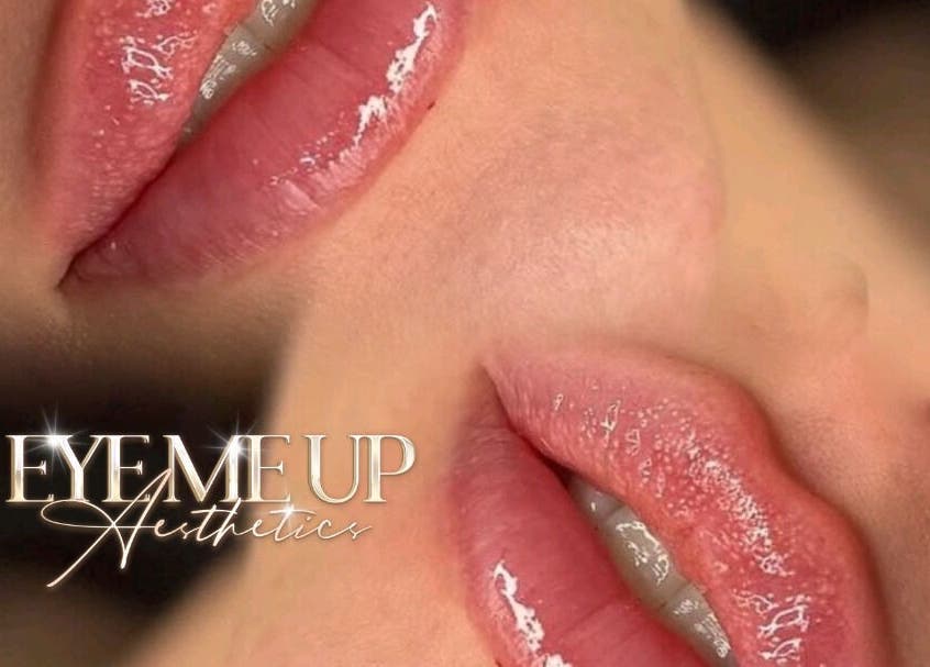 Close-up of glossy lips at Eye Me Up Aesthetics, Rainham, England, GB, showcasing expert beauty treatment.