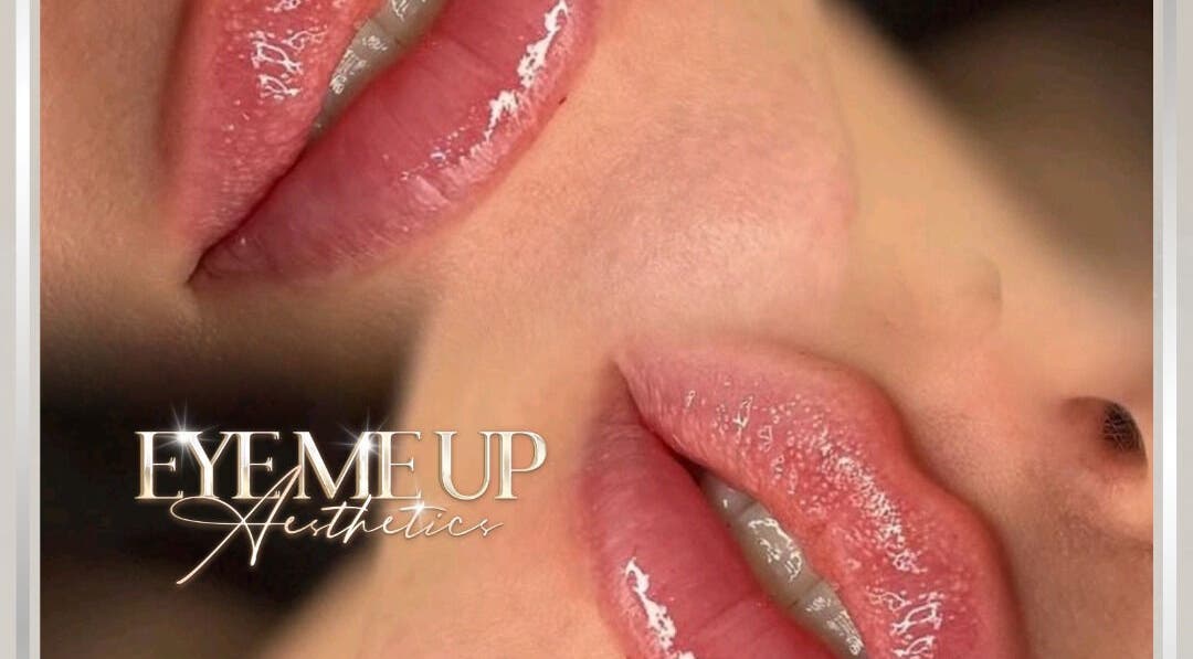 Close-up of glossy lips at Eye Me Up Aesthetics, Rainham, England, GB, showcasing expert beauty treatment.