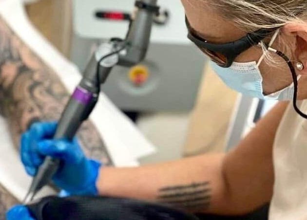 Professional tattoo removal at Unify Skin & Laser Clinic in Bathurst, New South Wales, AU. Expert care with precision.