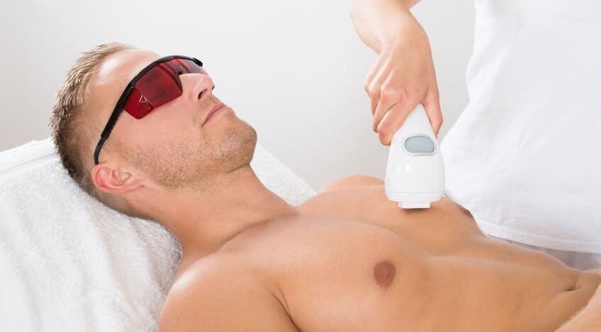 Man receives chest laser treatment at Beauty Expressed in Colours, Marsascala, MT.