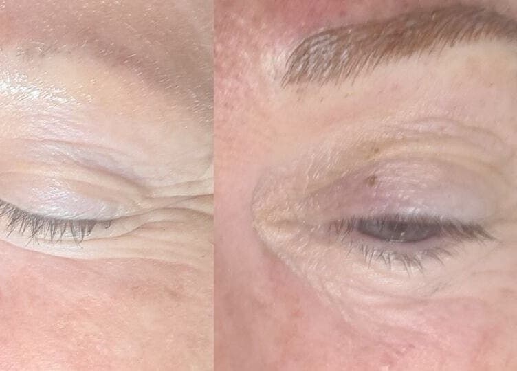Brow enhancement at Beauty Expressed in Colours, Marsascala, MT, showcasing before and after results.