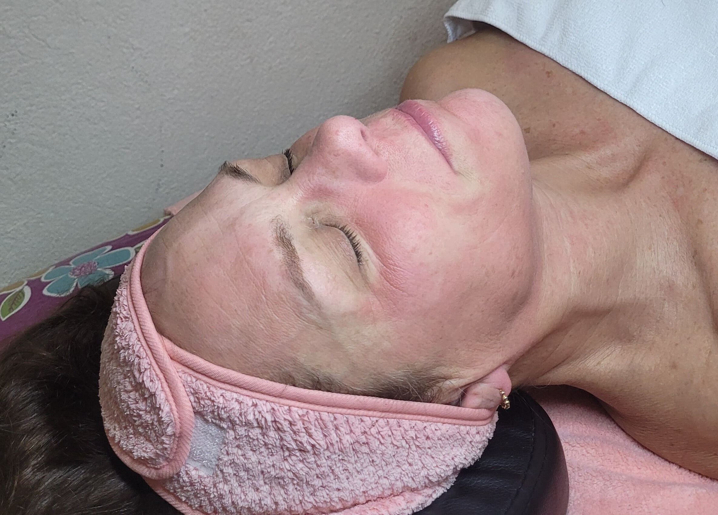 Facial treatment at M'Shantelle Beautii, Speightstown, Saint Peter, BB, showcasing rejuvenated skin.