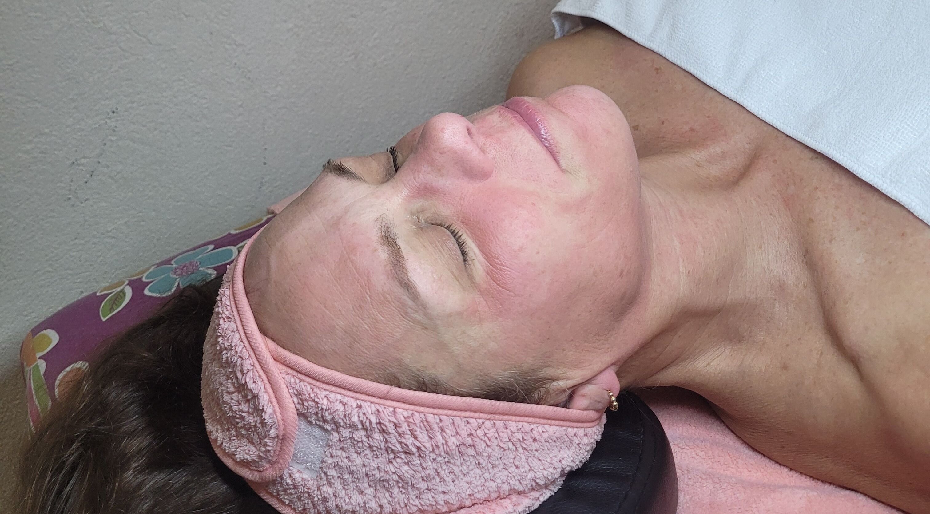 Facial treatment at M'Shantelle Beautii, Speightstown, Saint Peter, BB, showcasing rejuvenated skin.
