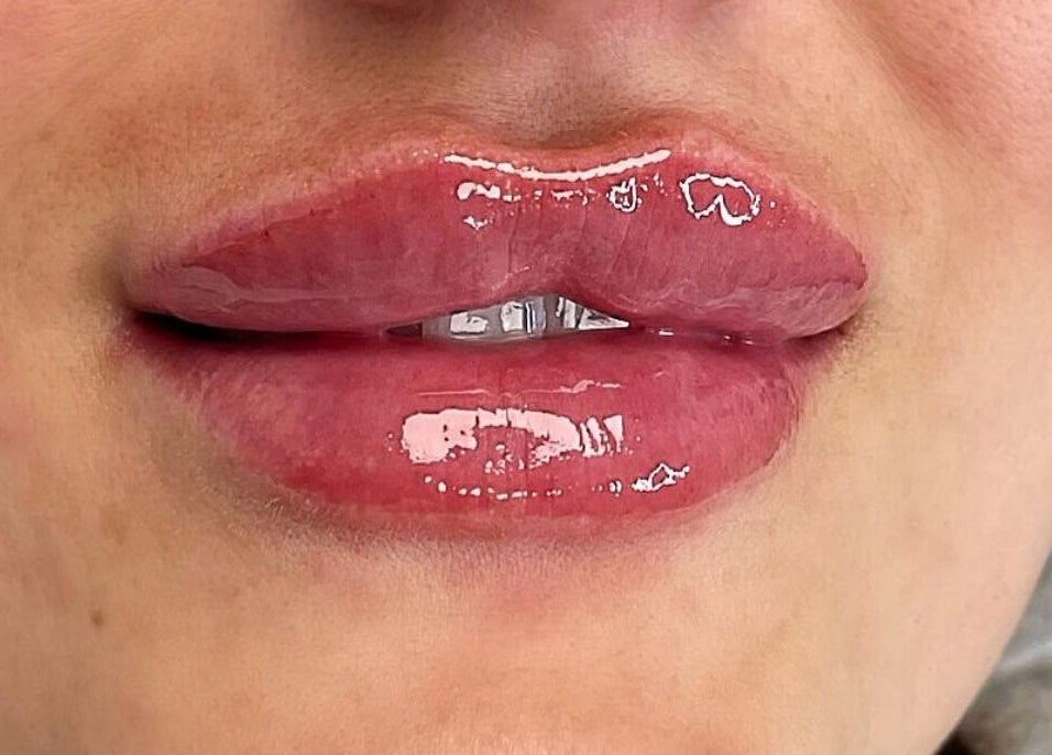 Close-up of glossy lips treatment at Sophiesticated Beauty, Thatcham, England, GB, showcasing vibrant results.