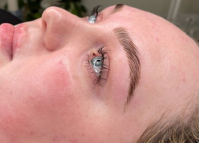 Relaxed face showcasing fresh treatment results at NAKD Beauty, Bridgend, Wales, GB.