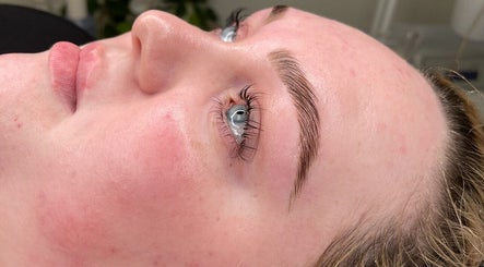 Relaxed face showcasing fresh treatment results at NAKD Beauty, Bridgend, Wales, GB.