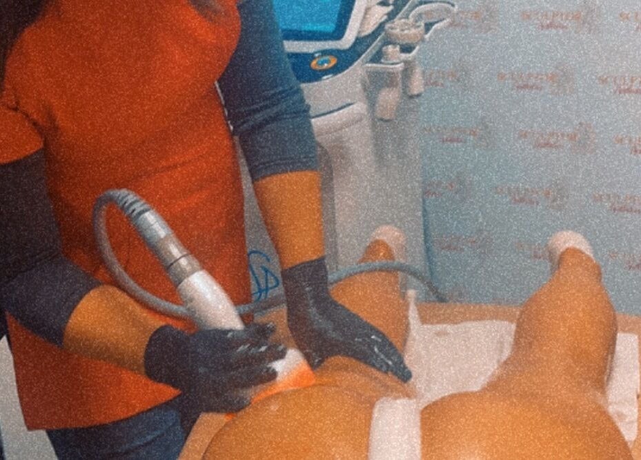 Aesthetic procedure in progress at Sculptor Aesthetics, Edgware, England, GB, highlighting advanced skincare techniques.