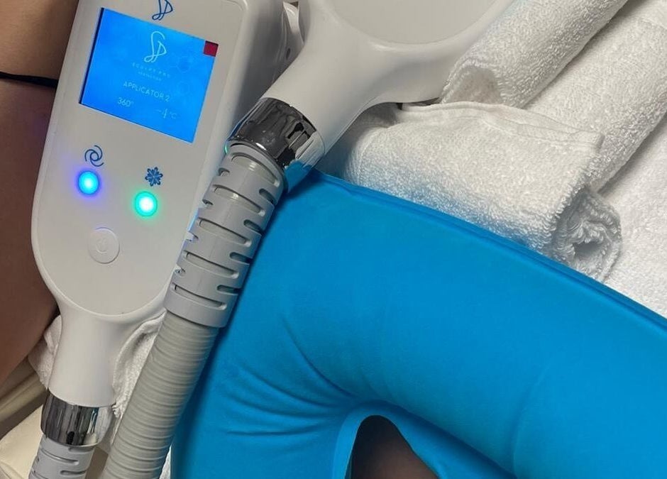 CoolTone device at Sculptor Aesthetics, Edgware, England, GB, showcasing advanced body sculpting technology.