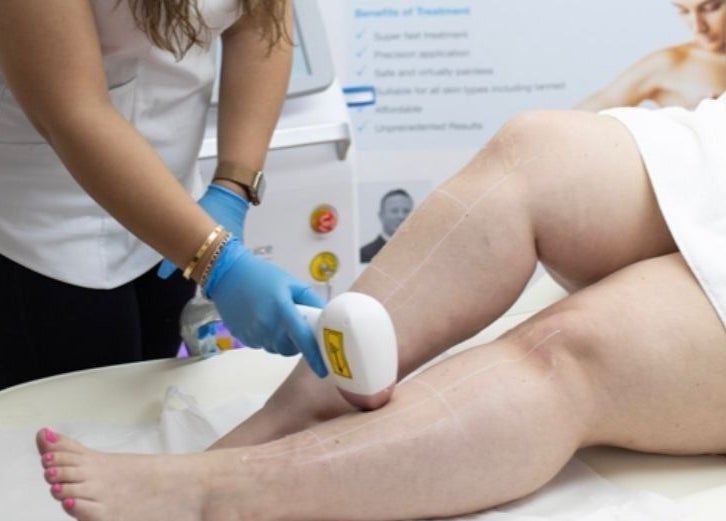 Laser treatment at Sculptor Aesthetics in Edgware, England, GB for flawless skin results.