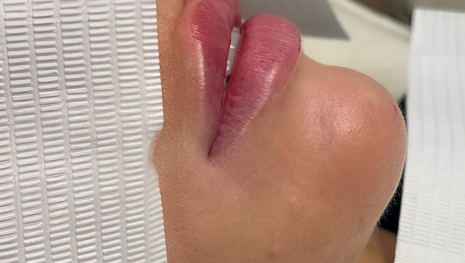 Close-up of enhanced lips after treatment at Enhanced Aesthetics Lashes Beauty, Bangor, Wales, GB.