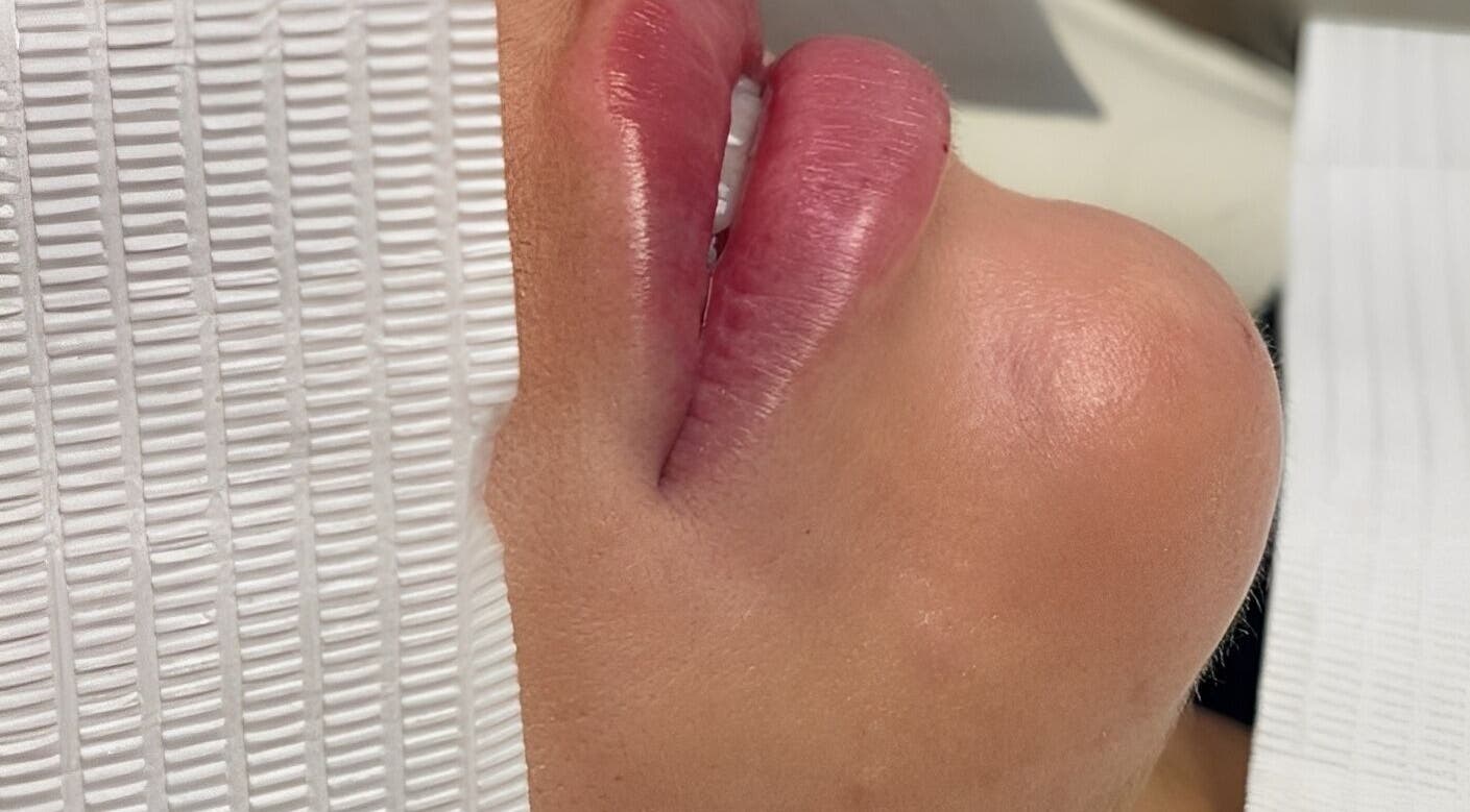 Close-up of enhanced lips after treatment at Enhanced Aesthetics Lashes Beauty, Bangor, Wales, GB.