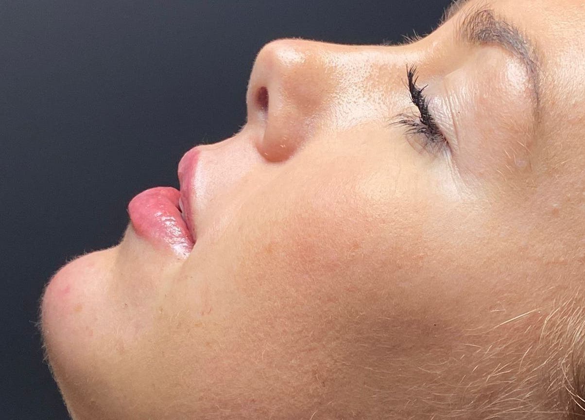 Relaxed woman's profile at Lucys Beauty Lounge, Addlestone, England, GB, epitomizing tranquility.