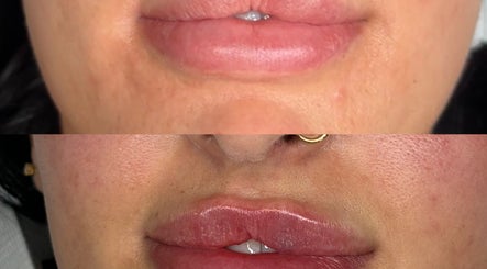 Sculpt Nails & Aesthetics image 3