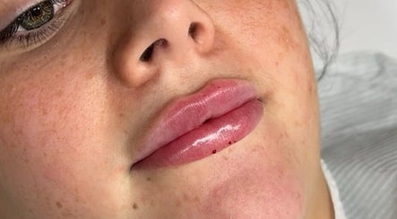 Close-up of glossy lips at Sculpt Nails & Aesthetics in Warrington, England, GB showcasing expert lip treatment.