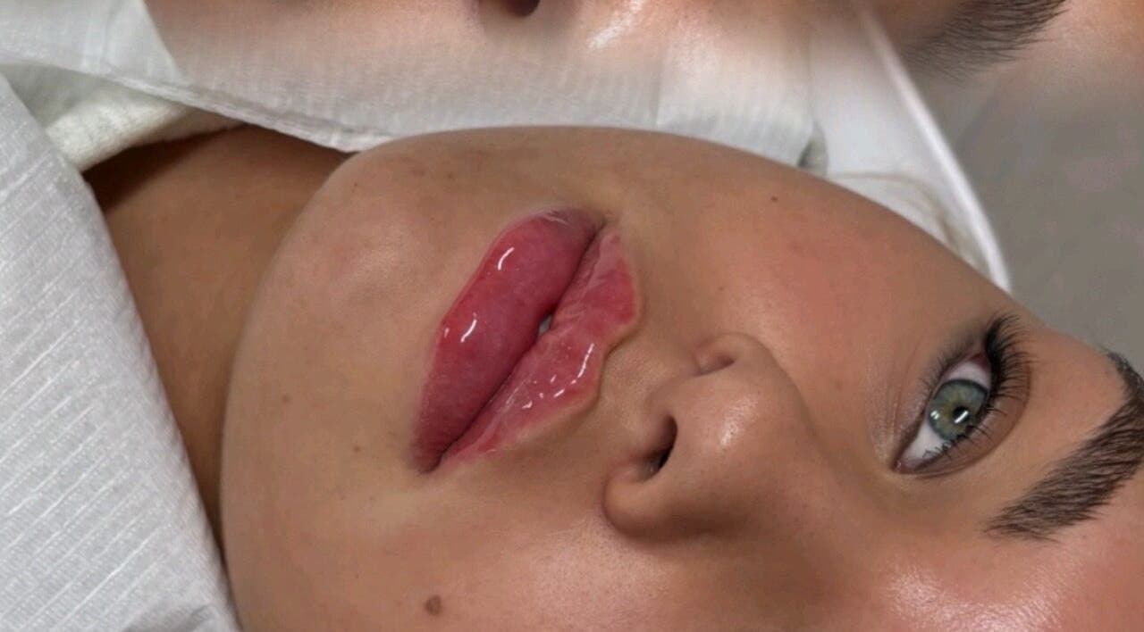 Close-up of glossy lips at Sculpt Nails & Aesthetics, Warrington, England, GB, highlighting beauty treatment.