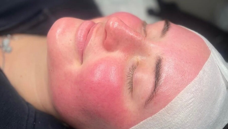 Radiant skin treatment at Rhijuvenate Skin & Healing, Royston, England, GB. Experience soothing facial rejuvenation.