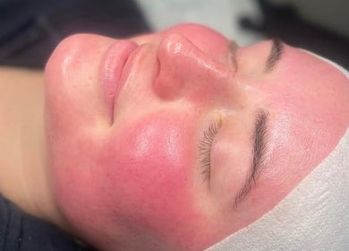 Radiant skin treatment at Rhijuvenate Skin & Healing, Royston, England, GB. Experience soothing facial rejuvenation.