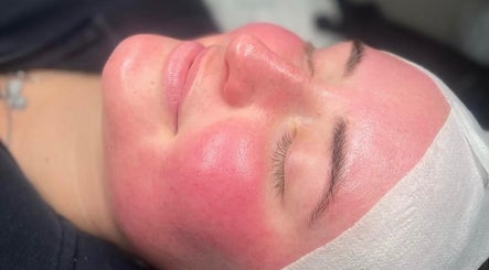Radiant skin treatment at Rhijuvenate Skin & Healing, Royston, England, GB. Experience soothing facial rejuvenation.