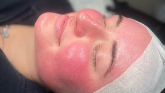 Rhijuvenate Skin & Healing