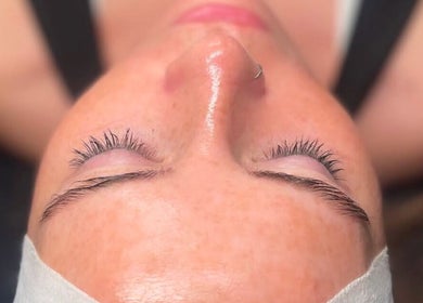 Facial treatment at Rhijuvenate Skin & Healing in Royston, England, GB; client with closed eyes and glowing skin.